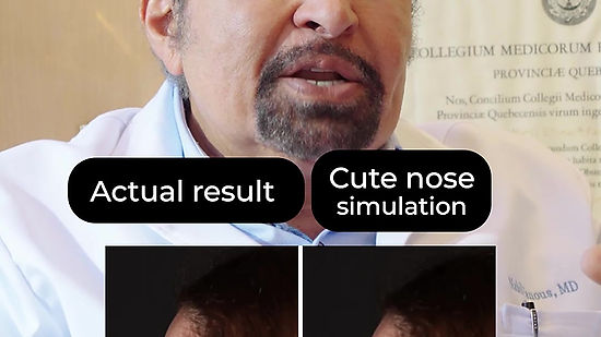 trendy noses (Video 11)